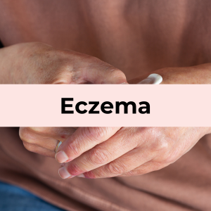 Eczema concern